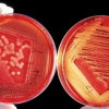 Microbiology: Characterization & Identification